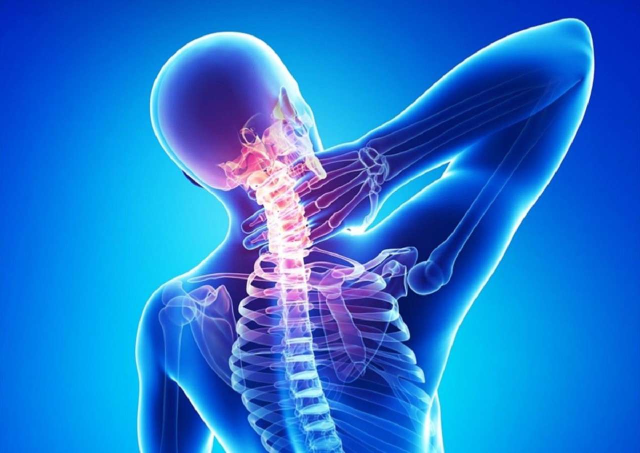 Hiểu về thoái hóa đốt sống cổ