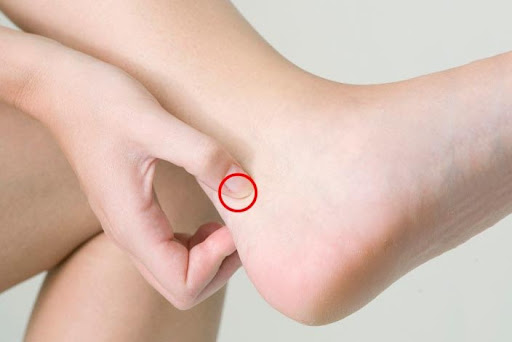Huyệt Thái khê hỗ trợ điều trị chứng hoa mắt, chóng mặt