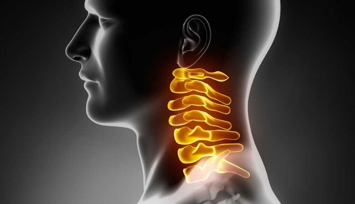 Thoái hoá đốt sống cổ