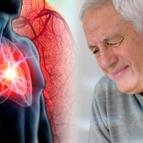 Đau Nhức Vùng Ức Là Dấu Hiệu Bệnh Gì?