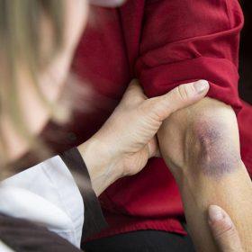 Lý Do Đau Nhức Cánh Tay Trái Và Cách Điều Trị