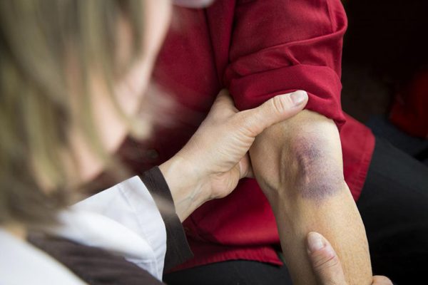 Lý Do Đau Nhức Cánh Tay Trái Và Cách Điều Trị