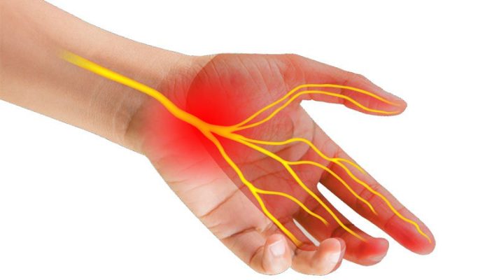 Đau nhức cánh tay phải là triệu chứng của bệnh gì và cách điều trị