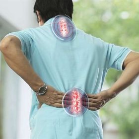 Vôi hóa xương: Nguyên nhân và phương pháp điều trị