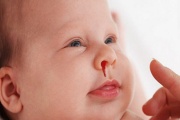 Khi trẻ bị chảy máu cam nên ăn gì để trị khỏi dứt điểm