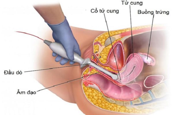 Siêu âm đầu giò là gì? Siêu âm đầu dò có hại không?