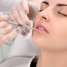 Tiêm filler có hại về sau không, những lưu ý an toàn khi tiêm