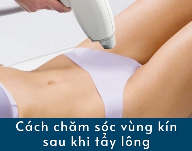 Mách bạn cách hướng dẫn chăm sóc da vùng kín sau khi tẩy lông hiệu quả nhất