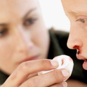 Mách bạn: Mẹo chữa chảy máu cam an toàn, dễ dàng áp dụng