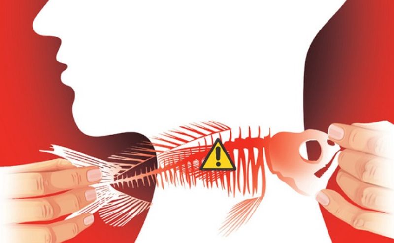 [Nắm lòng] Mẹo chữa hóc xương cá bằng đũa