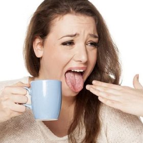 Mách bạn: Mẹo chữa rát lưỡi đơn giản & hiệu quả