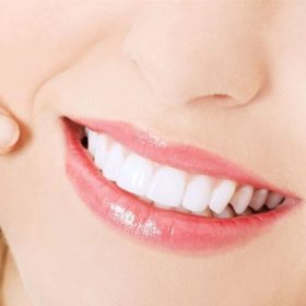 Mẹo làm trắng răng đơn giản, hiệu quả bất ngờ