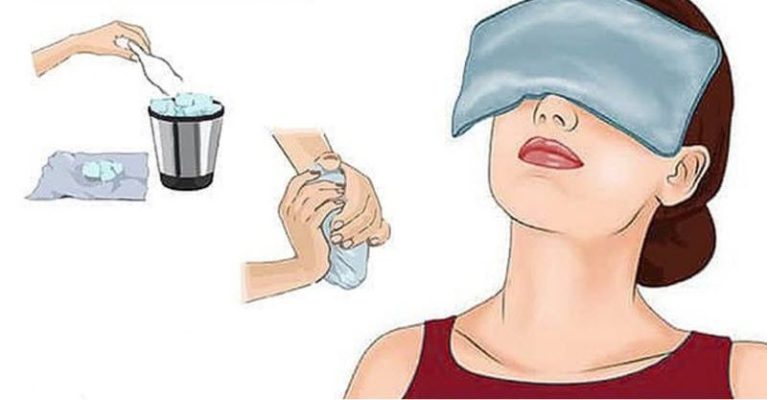 Bỏ túi mẹo trị đau mắt đỏ tại nhà