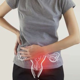 Nhân xơ tử cung kiêng ăn gì để tránh biến chứng?