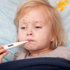 Sốt phát ban ở trẻ nhỏ - căn bệnh không thể coi thường