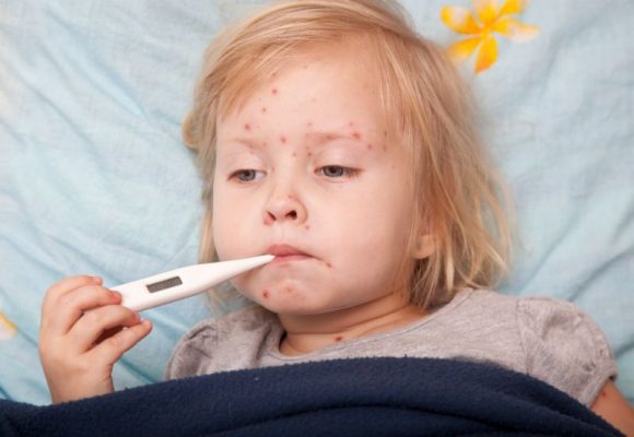 Sốt phát ban ở trẻ nhỏ - căn bệnh không thể coi thường