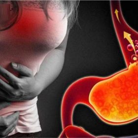 Tổng hợp tuyệt chiêu chữa trào ngược dạ dày gây mất ngủ hiệu quả cần nên biết