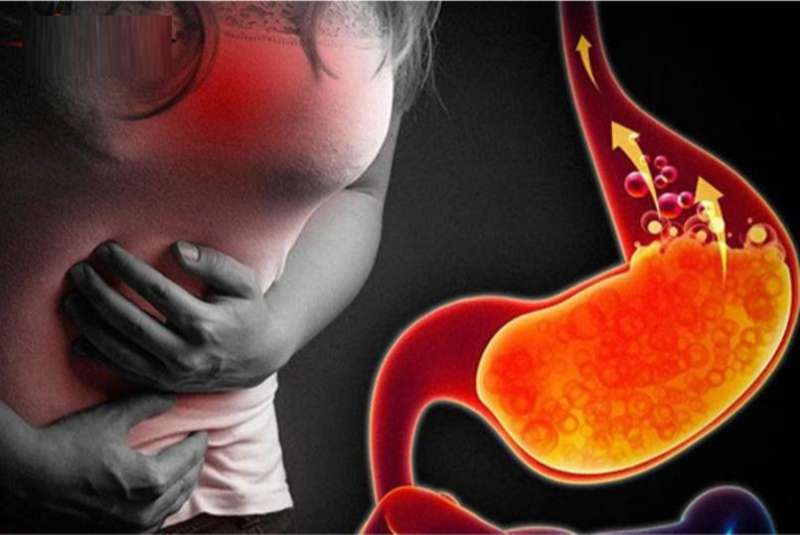 Tổng hợp tuyệt chiêu chữa trào ngược dạ dày gây mất ngủ hiệu quả cần nên biết